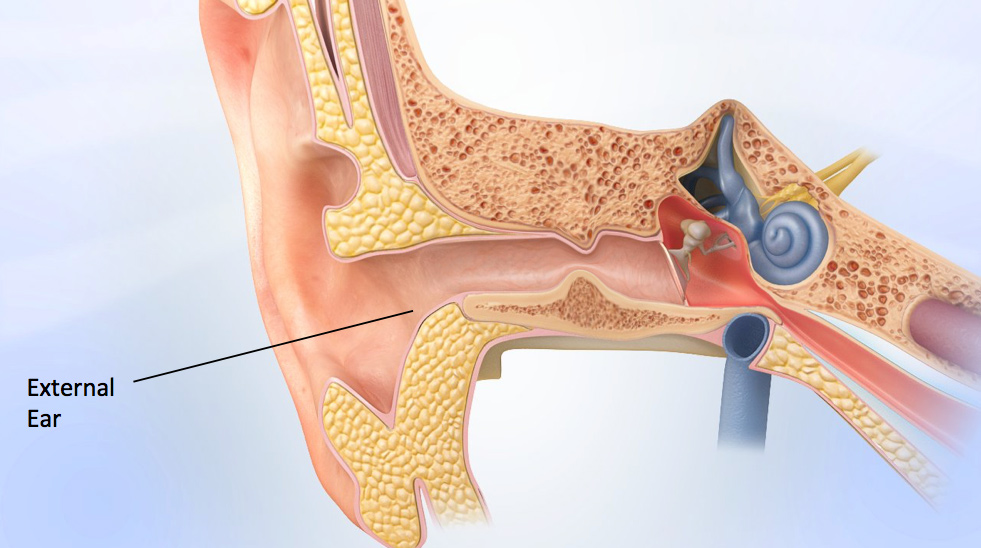 surfer-s-ear-treatment-los-angeles-ca